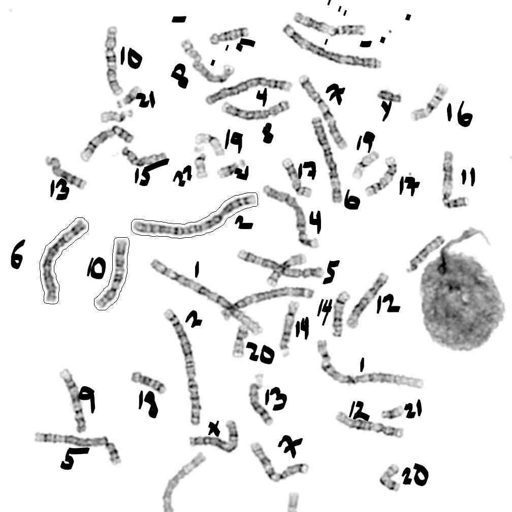 karyotype analysis, annotated